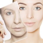 Best Facial Wrinkle Treatment Options