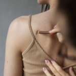 How to Remove Skin Tags Safely at Home